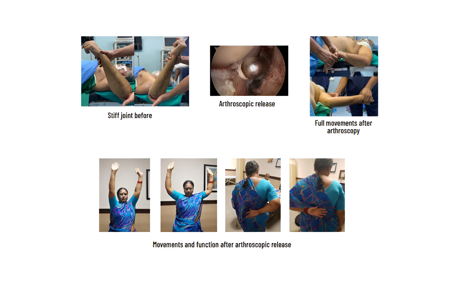 19-Picsart-AiImageEnhancer