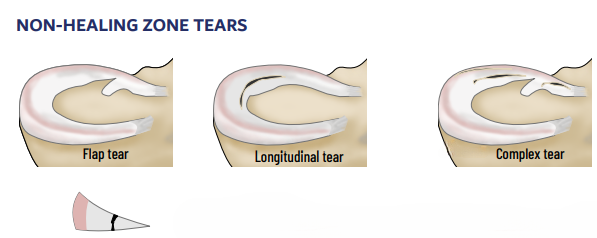 Screenshot 2025-05-01 152515_cleanup (1)