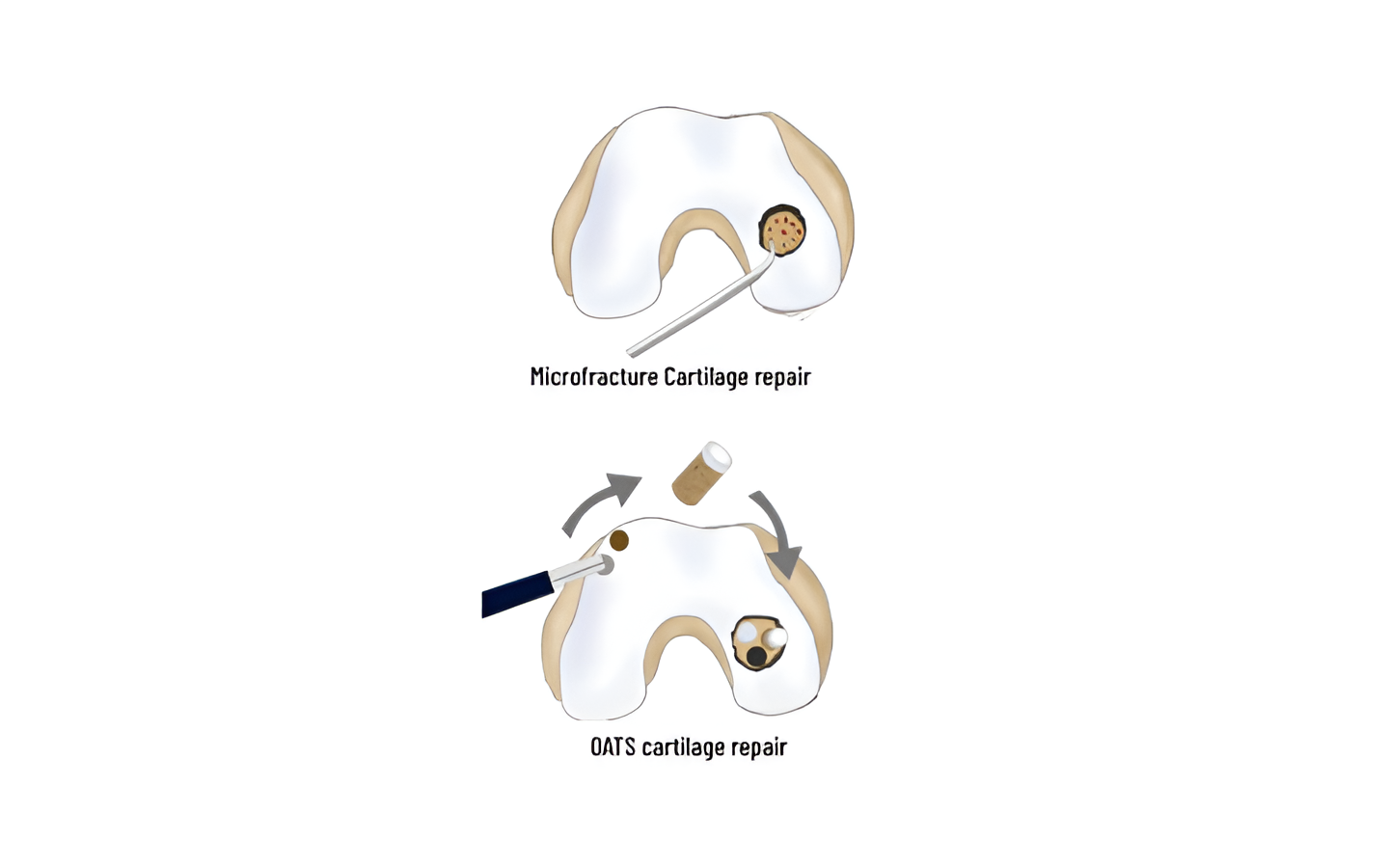 normal knee (7)_cleanup-Picsart-AiImageEnhancer
